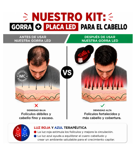 Gorra de Terapia de Luz Roja para Crecimiento Capilar